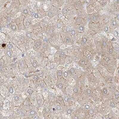 Immunohistochemistry-Paraffin: PGD Antibody [NBP1-85925]