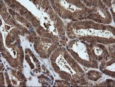 Immunohistochemistry: PGD Antibody (OTI2A5) - Azide and BSA Free [NBP2-73361]
