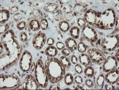 Immunohistochemistry: PGD Antibody (OTI2A5) - Azide and BSA Free [NBP2-73361]
