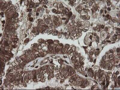 Immunohistochemistry: PGD Antibody (OTI2A5) - Azide and BSA Free [NBP2-73361]