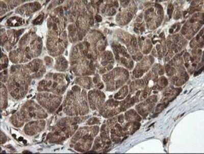 Immunohistochemistry: PGD Antibody (OTI2A5) - Azide and BSA Free [NBP2-73361]
