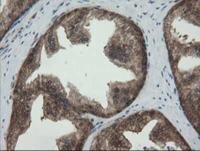 Immunohistochemistry: PGD Antibody (OTI2A5) - Azide and BSA Free [NBP2-73361]