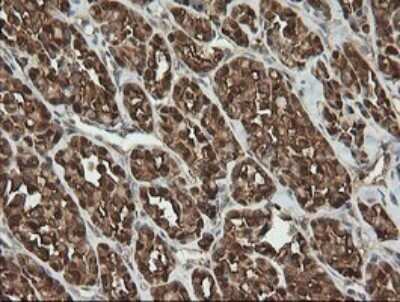 Immunohistochemistry: PGD Antibody (OTI2A5) - Azide and BSA Free [NBP2-73361]