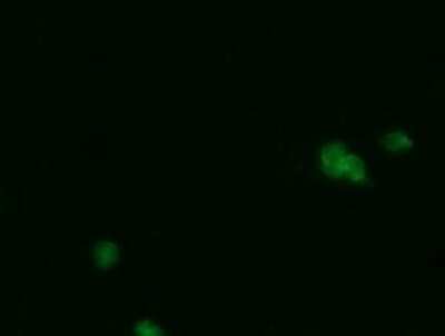 Immunofluorescence: PGD Antibody (OTI2A5) [NBP2-45880]