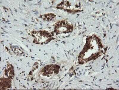 Immunohistochemistry-Paraffin: PGD Antibody (OTI2A5) [NBP2-45880]