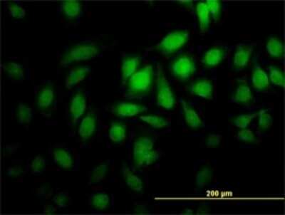 Immunocytochemistry/ Immunofluorescence: PGGT1B Antibody (5E4) [H00005229-M02]