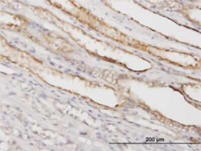 Immunohistochemistry-Paraffin: PGGT1B Antibody (5E4) [H00005229-M02]