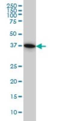 Western Blot: PGGT1B Antibody (5E4) [H00005229-M02]
