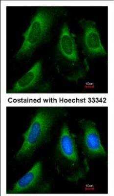 Immunocytochemistry/ Immunofluorescence: PGK1 Antibody [NBP2-19784]