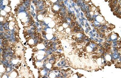 Immunohistochemistry-Paraffin: PGK1 Antibody [NBP1-55154]