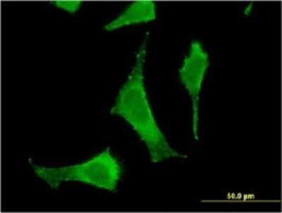 Immunocytochemistry/ Immunofluorescence: PGLS Antibody (2D9) [H00025796-M01]