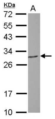 Western Blot: PGLS Antibody [NBP2-19785]