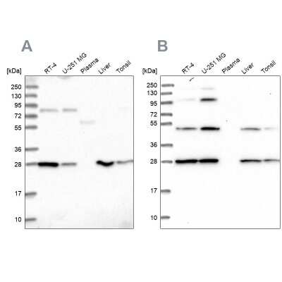 Western Blot: PGLS Antibody [NBP2-47334]