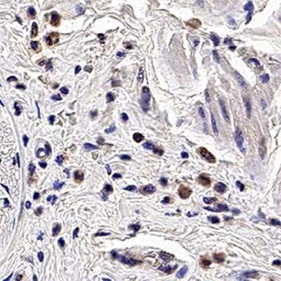 Immunohistochemistry: PGLYRP1/PGRP-S Antibody (188C424) - Azide and BSA Free [NBP2-80909]