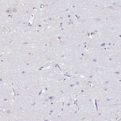 Immunohistochemistry-Paraffin: PGLYRP1/PGRP-S Antibody [NBP1-92261]