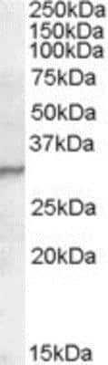 Western Blot: PGLYRP1/PGRP-S Antibody [NBP1-20962]