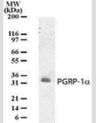 Western Blot: PGLYRP3/PGRPIA Antibody (187C434) [NB100-56729]