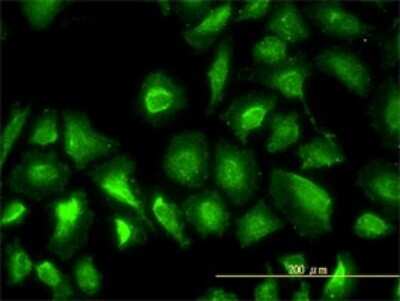 Immunocytochemistry/ Immunofluorescence: PGM1 Antibody (3B8-H4) [H00005236-M01]