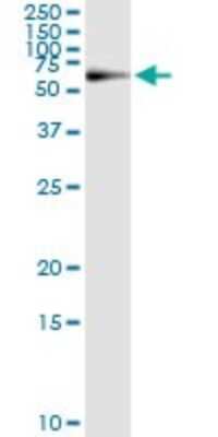 Immunoprecipitation: PGM1 Antibody (3B8-H4) [H00005236-M01]