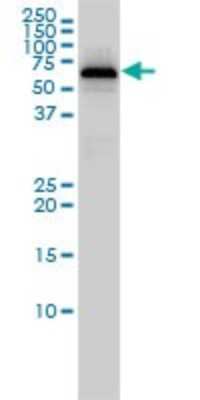 Western Blot: PGM1 Antibody (3B8-H4) [H00005236-M01]