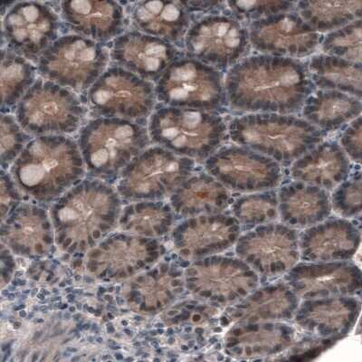 Immunohistochemistry-Paraffin: PGM1 Antibody (CL3301) [NBP2-59026]