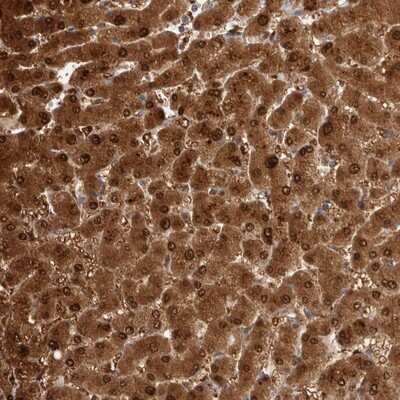 Immunohistochemistry-Paraffin: PGM1 Antibody [NBP1-85977]