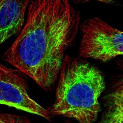 Immunocytochemistry/ Immunofluorescence: PGM2 Antibody [NBP2-32601]