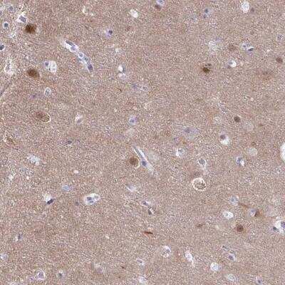 Immunohistochemistry-Paraffin: PGM2L1 Antibody [NBP2-31656]