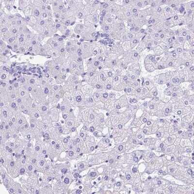 Immunohistochemistry-Paraffin: PGM2L1 Antibody [NBP2-31656]