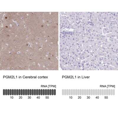 Immunohistochemistry-Paraffin: PGM2L1 Antibody [NBP2-31656]