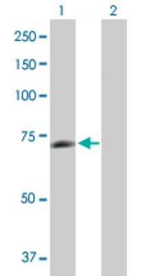 Western Blot: PGM2L1 Antibody [H00283209-B01P]