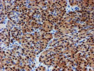 Immunohistochemistry-Paraffin: PGM3 Antibody (OTI1A11) [NBP2-03734]