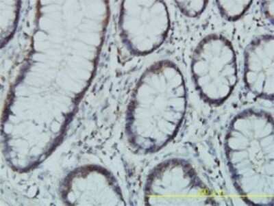 Immunohistochemistry-Paraffin: PGM3 Antibody (1E2-1B12) [H00005238-M01]