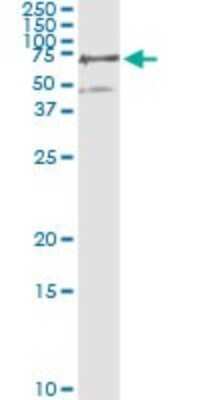 Immunoprecipitation: PGM3 Antibody (1E2-1B12) [H00005238-M01]