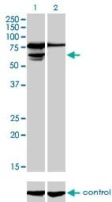 Western Blot: PGM3 Antibody (1E2-1B12) [H00005238-M01]