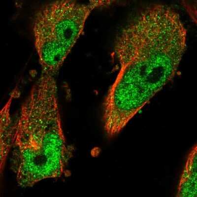 Immunocytochemistry/ Immunofluorescence: PGM3 Antibody [NBP1-89208]