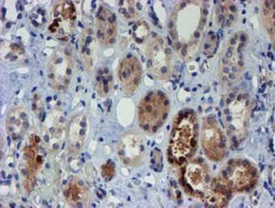 Immunohistochemistry: PGM3 Antibody (OTI1A11) - Azide and BSA Free [NBP2-73362]