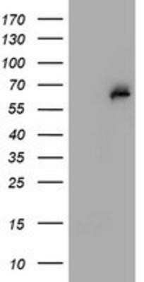 Western Blot: PGM3 Antibody (OTI1A11)Azide and BSA Free [NBP2-73362]