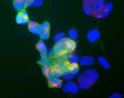 Immunocytochemistry/ Immunofluorescence: UCH-L1/PGP9.5 Antibody (BH7) [NB110-58869]