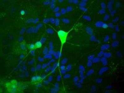 Immunocytochemistry/ Immunofluorescence: UCH-L1/PGP9.5 Antibody [NB110-58874]