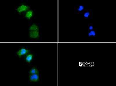 Immunocytochemistry/ Immunofluorescence: UCH-L1/PGP9.5 Antibody [NB300-675]