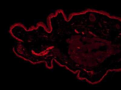Immunocytochemistry/ Immunofluorescence: UCH-L1/PGP9.5 Antibody [NB300-675]