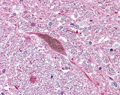 Immunohistochemistry: UCH-L1/PGP9.5 Antibody [NB300-675]