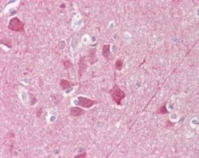 Immunohistochemistry-Paraffin: UCH-L1/PGP9.5 Antibody [NBP2-24781]