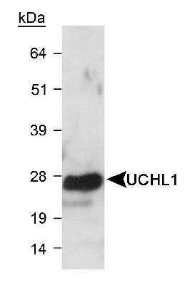 Western Blot: UCH-L1/PGP9.5 Antibody [NB300-675]