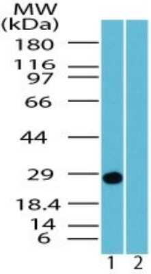 Western Blot: UCH-L1/PGP9.5 Antibody [NBP2-24781]