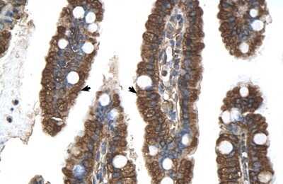 Immunohistochemistry-Paraffin: PGRMC1 Antibody [NBP1-59827]