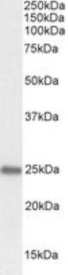 Tumorsphere: PGRMC1 Antibody [NB100-2841]