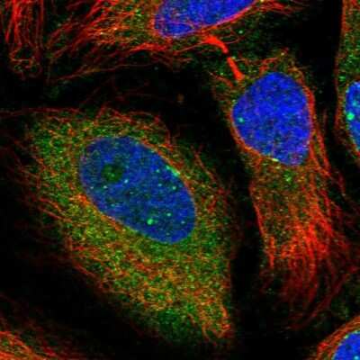 Immunocytochemistry/ Immunofluorescence: PGRMC2 Antibody [NBP2-13753]