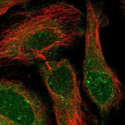 Immunocytochemistry/ Immunofluorescence: PGRMC2 Antibody [NBP2-13753]